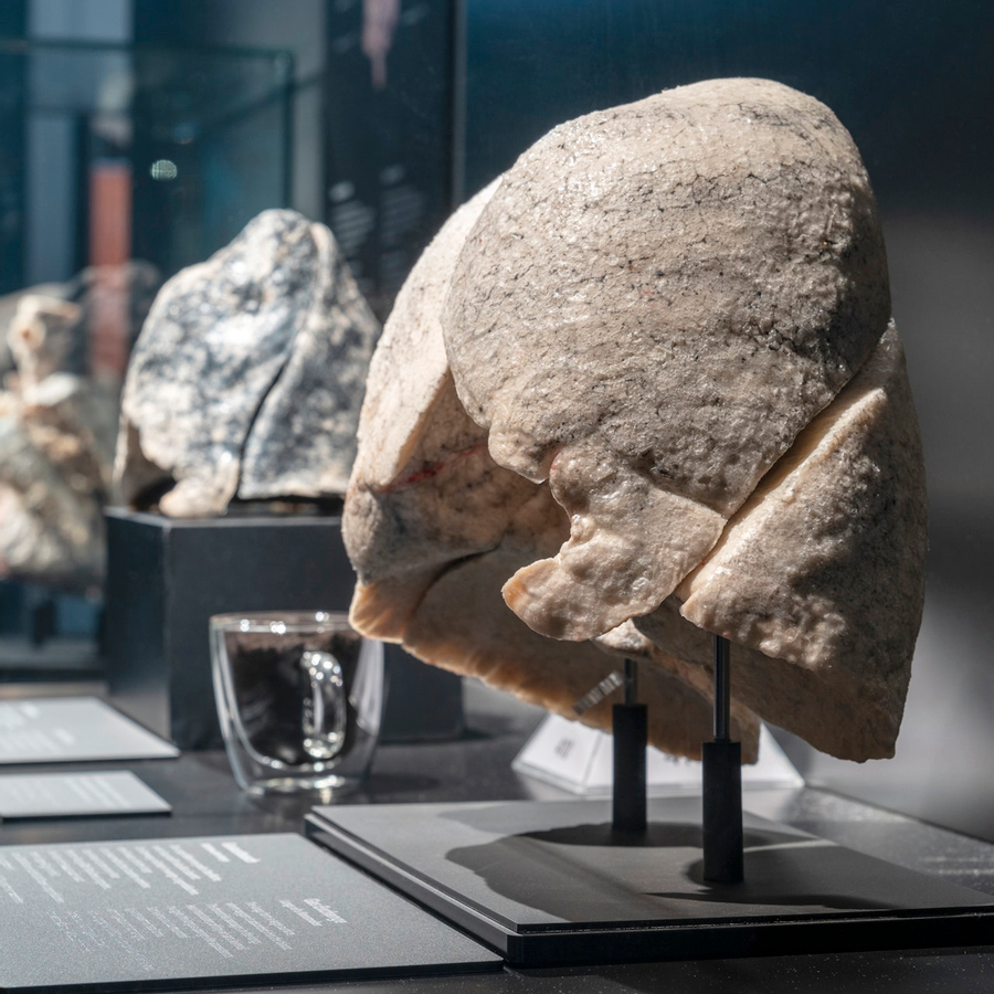 BODY WORLDS Berlin oPID54h0