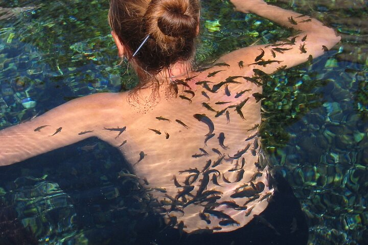 Psoriasis Fish Treatment by Garra Rufa Dr Fish in Turkey for 21 Days AV1Q4Yzz
