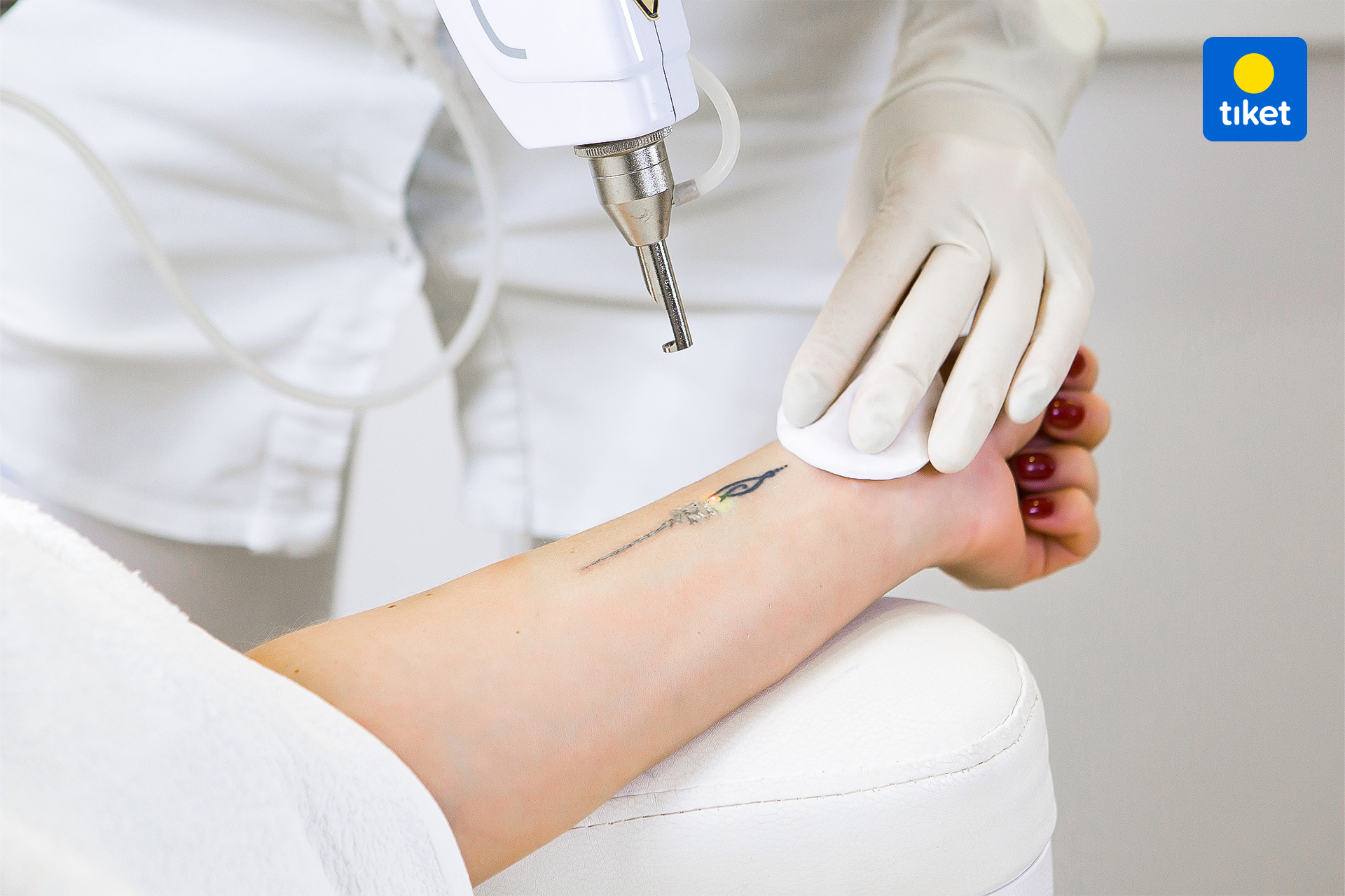 tattoo removal laser penghilang tato tiket.jpg