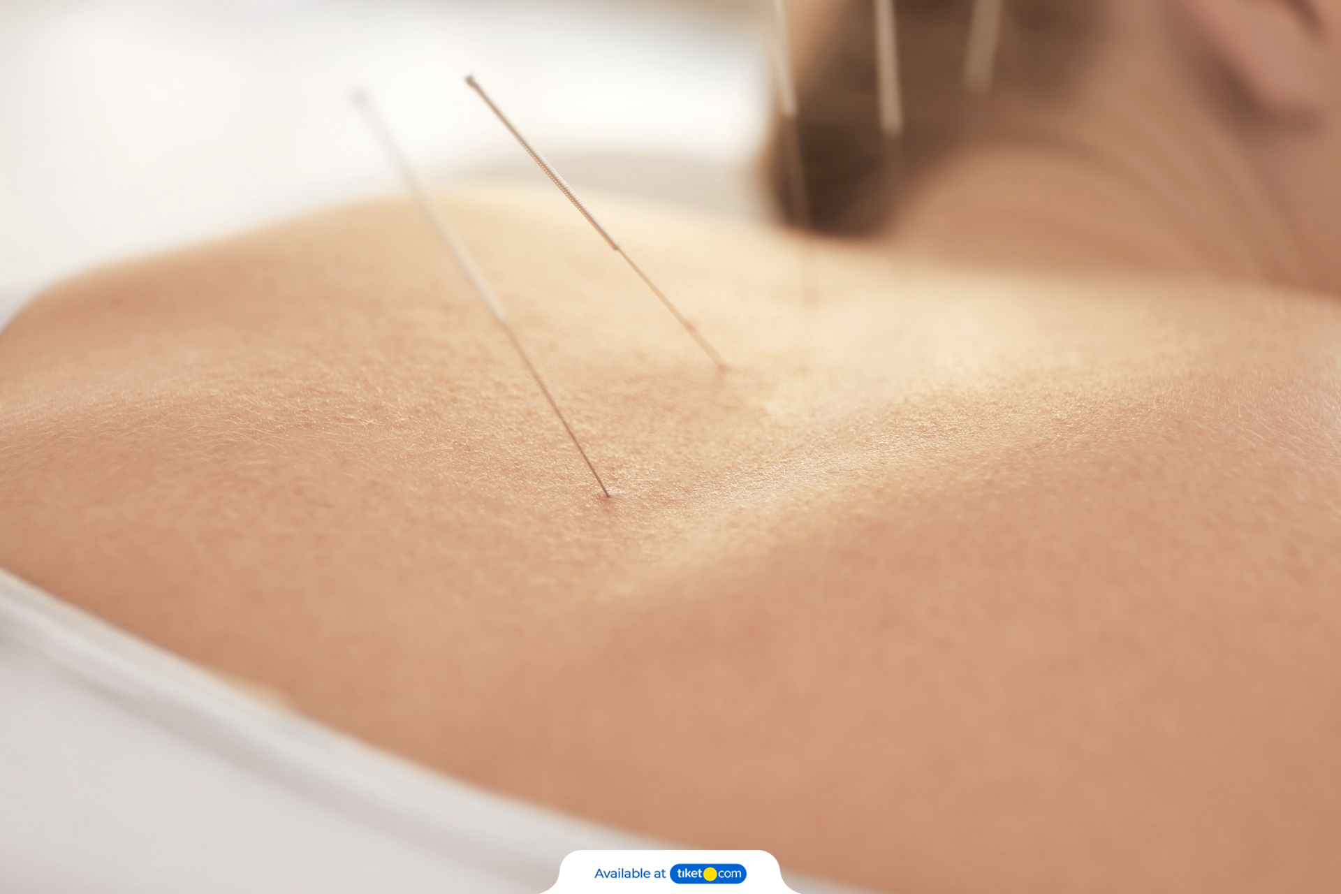 body acupuncture4.jpg-backdrop