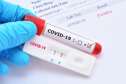[HOME TEST] COVID-19 RT-PCR and Rapid Test in Ha Noi by eDoctor