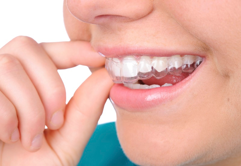 Ho Chi Minh Dental Clinic: Check Up, Whitening & Cleaning at Parkway 5pcyZejq