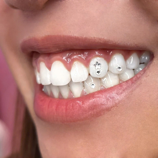 Tooth Gems Buffet: Sparkle Your Smile in Hanoi WHYwsBkq